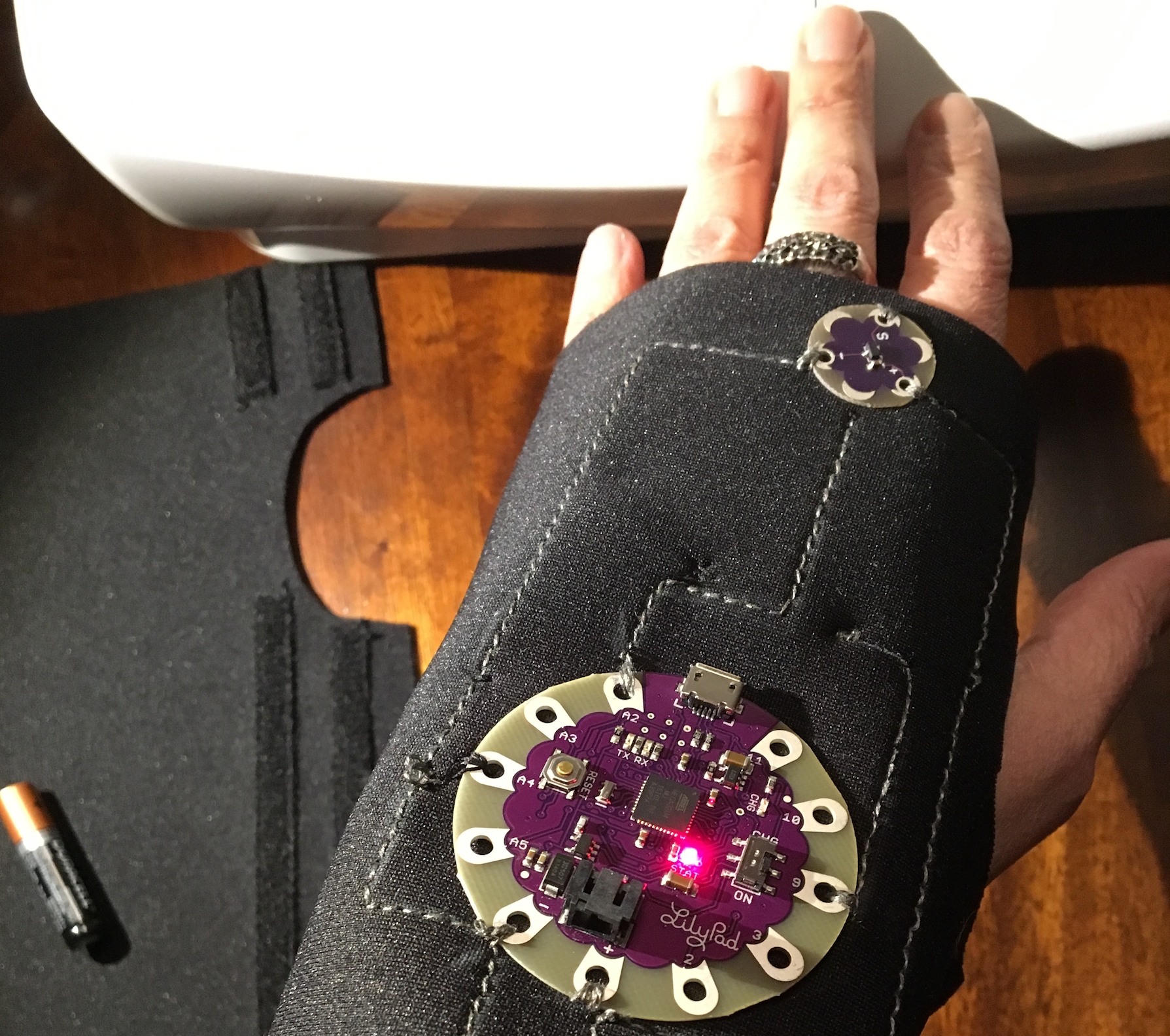 raynaud's smart glove